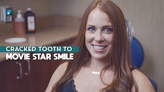 From Cracked Tooth to Dream Smile with Veneers