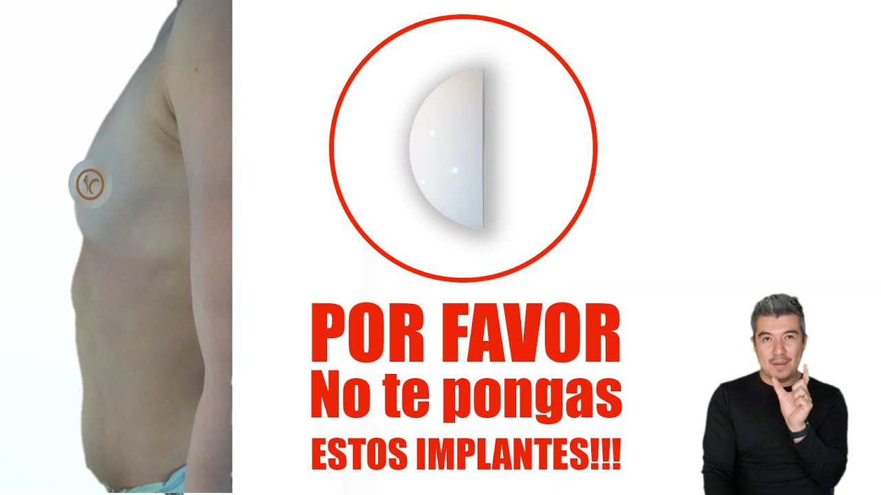 Ilich Sandino Ríos García-8