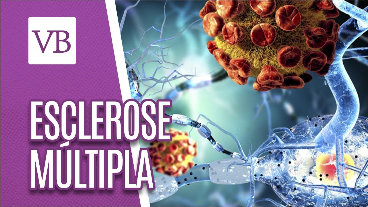 Esclerose Múltipla: alimentos que previnem e auxiliam na doença - Você Bonita (29/08/18)