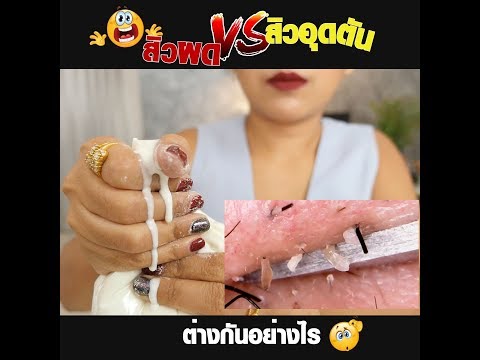 เตรียมรัสเซียสำหรับความคิดเห็นเรี่ยวแรง เป็นแรงของ Viagra อะไร