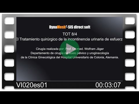 DynaMesh®-SIS direct soft - OR-Video - El Tratamiento quirúgico de la UI de esfuerzo