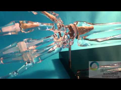 Extremity Acrylic Model of the Hand and Wrist