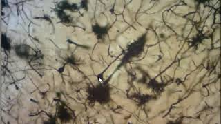 SNC coloreado mediante impregnación argéntica de Golgi