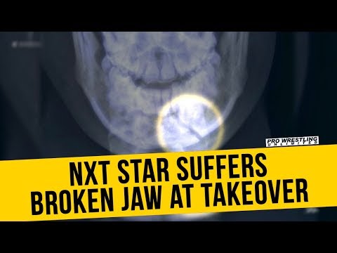 Lars Sullivan “Broke His Jaw” During The NXT Championship Match Against Aleister Black At TakeOver: Chicago II