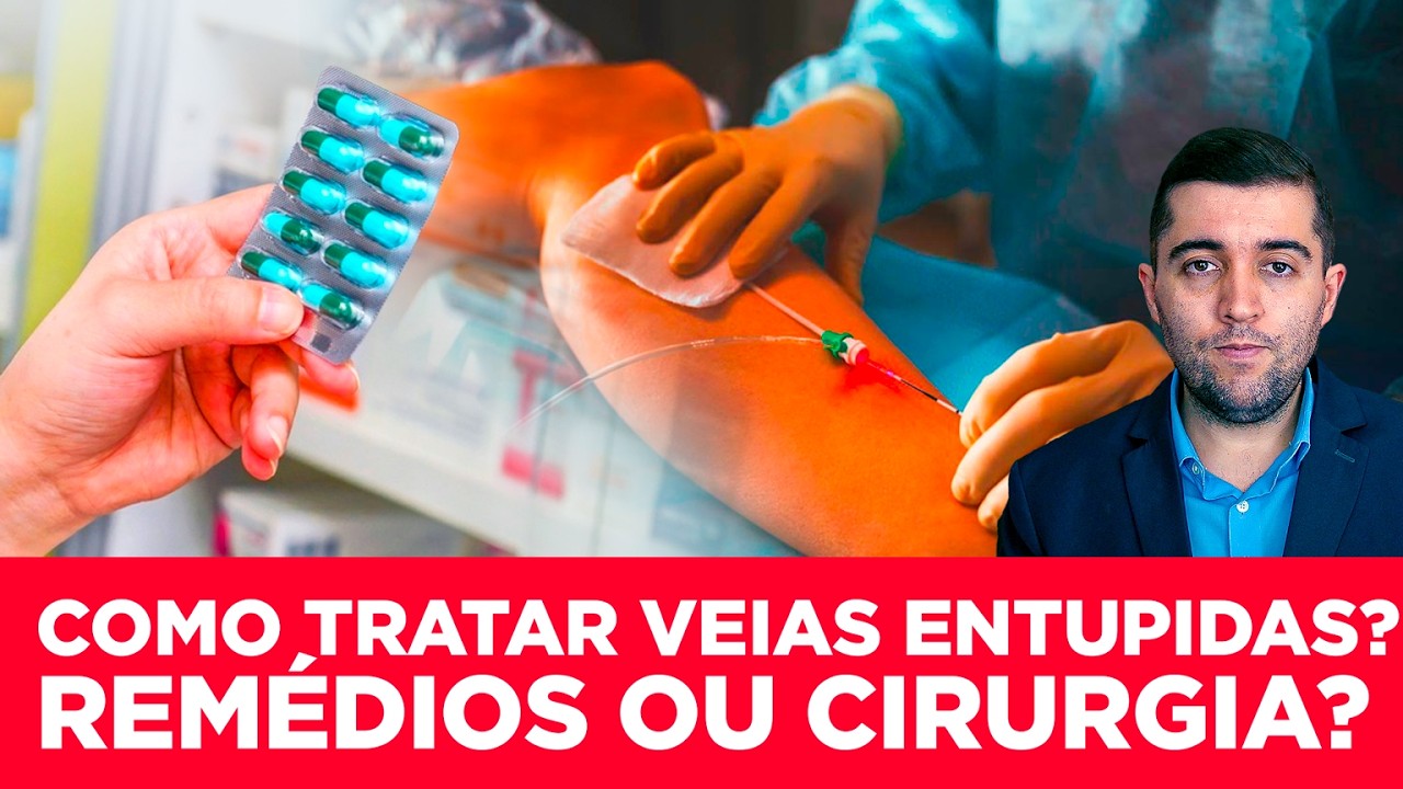 Como cuidar das veias: tratamentos eficazes para refluxo de safena, má circulação,coágulos e varizes