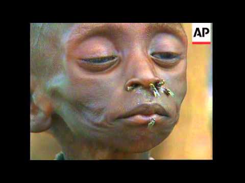 download lagu mp3 mp4 Famine, download mp3 Famine free download, download mp3 Famine