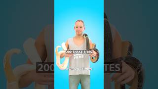 Man Injects Snake Venom On Purpose 😳 Surgeon Reacts
