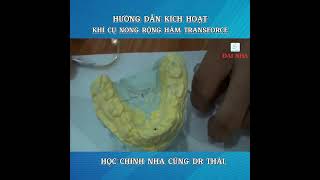 Hướng dẫn kích hoạt khí cụ nong hàm Transforce. #nhakhoa #niengrang #dainha #kienthuc #dentist