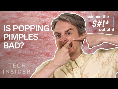 痘痘別亂擠！小心噩夢纏身！(Why Popping Your Pimples Is Bad For You)