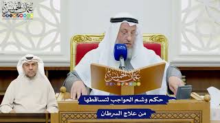 484 - حكم وشم الحواجب لتساقطها من علاج السرطان - عثمان الخميس
