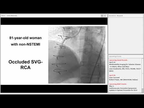 Emmanouil Brilakis - Update on Chronic Total Occlusion (CTO) Percutaneous Coronary Intervention
