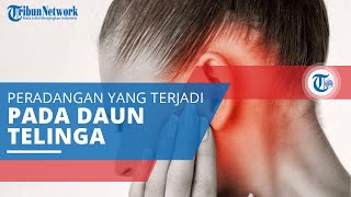 Perikondritis, Peradangan yang Terjadi pada Daun Telinga yang Bisa Sebabkan Cedera Permanen