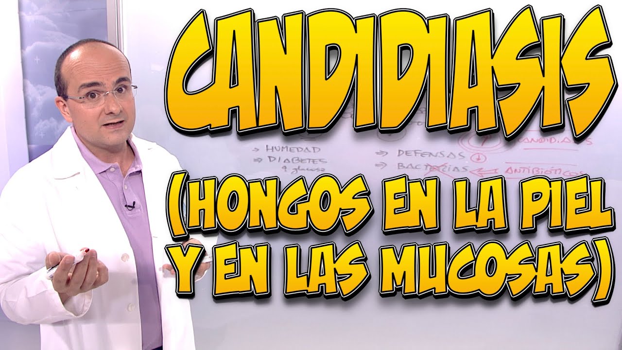 Candidiasis Hongos en la piel y en las mucosas