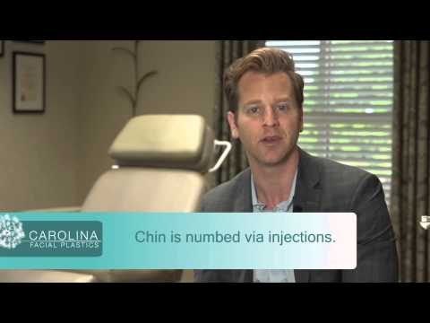 In Office Chin Implant In Office Chin Implant
