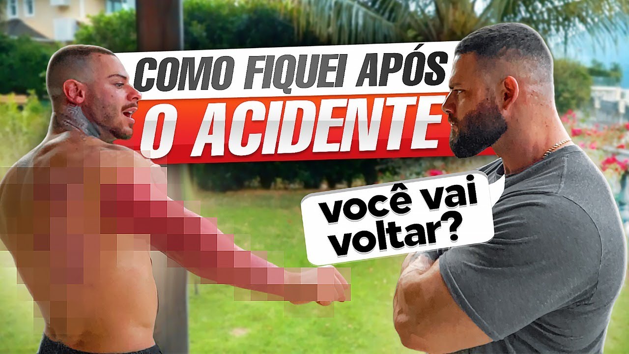 COMO ESTOU APOS O ACIDENTE! - LEO STRONDA