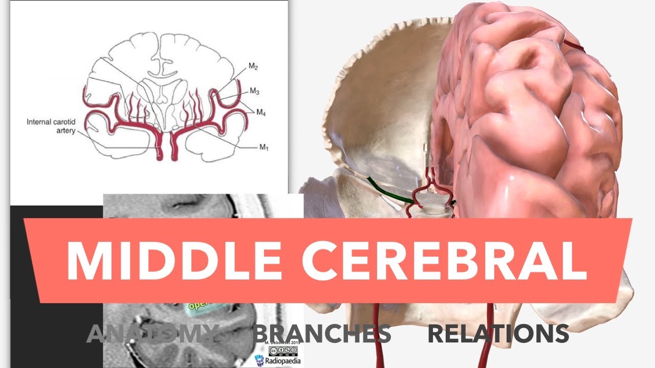 Middle Cerebral Artery - Anatomy, Branches & Relations