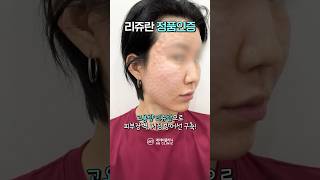 고용량 리쥬란 정품 인증!