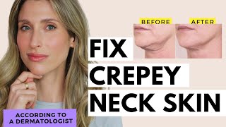 How to Fix Saggy Neck Skin | Dr. Sam Ellis
