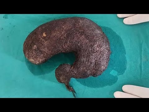 Nel quale i pesci di mare là non sono nessun helminths Quello che è necessario per fare prove su parassiti