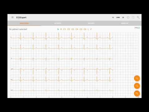 ECG Expert