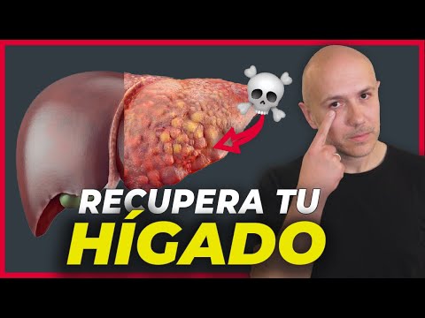 Así Se Cura El Hígado Graso (Sin Medicamentos) | Dr. Carlos Jaramillo