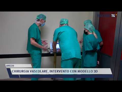 2021-12-08 AREZZO - CHIRURGIA VASCOLARE, INTERVENTO CON MODELLO 3D
