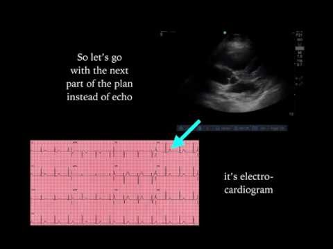 The EMC - Chap 3 - ECGs in PE