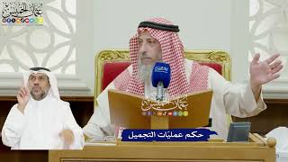 877 - حكم عمليّات التجميل - عثمان الخميس