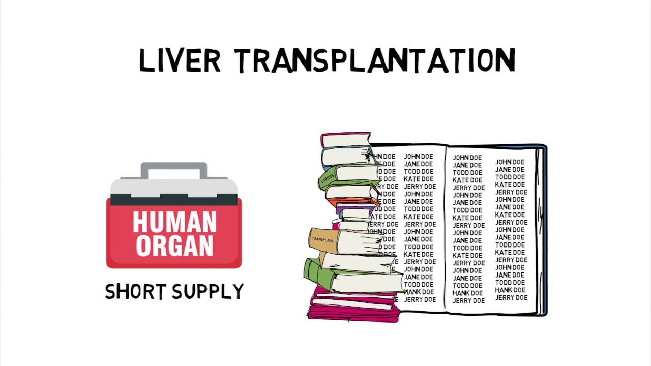 HCC Whiteboard #1: The Epidemiology of Hepatocellular Carcinoma and Current Standard of Care