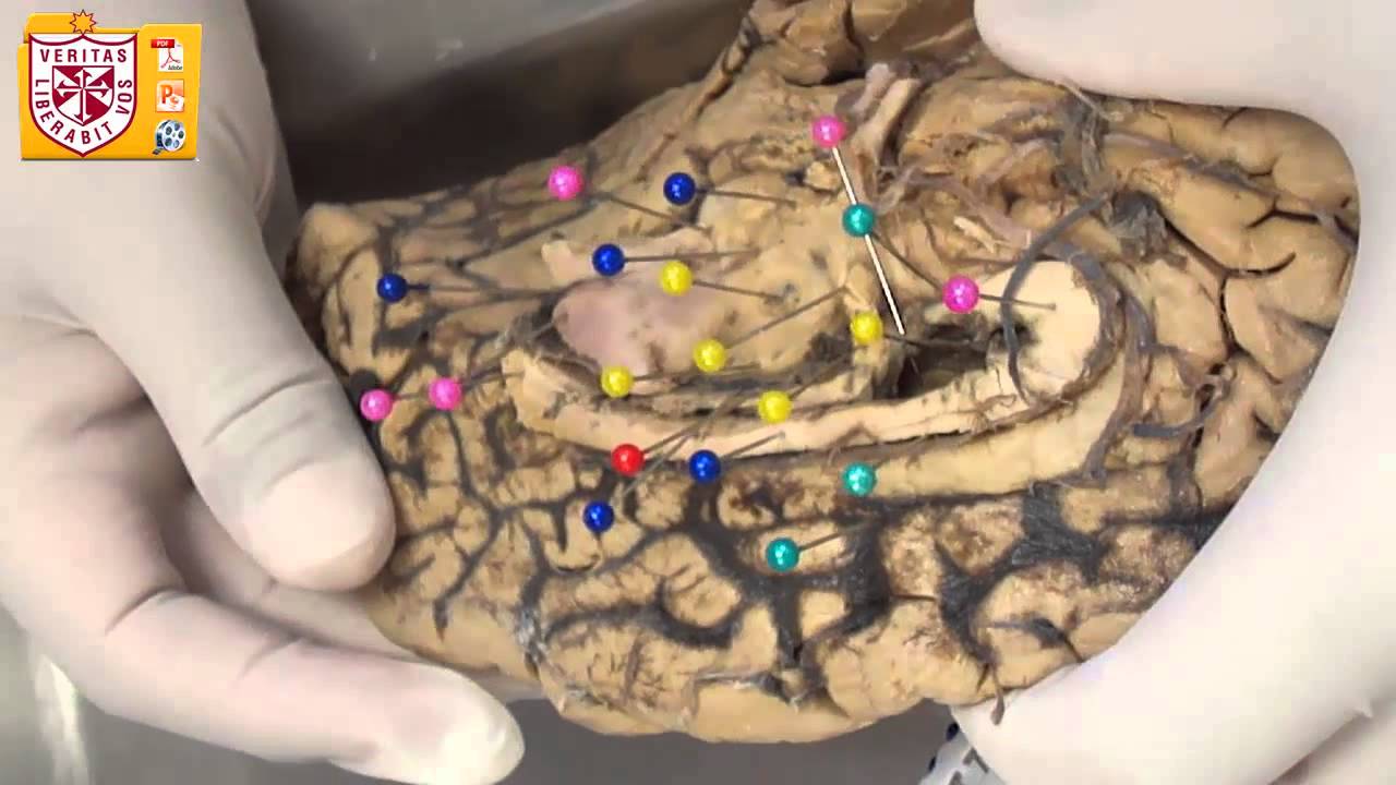 Anatomía [Lab] - Diencéfalo, Tálamo y Subtálamo
