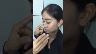 ซิลิโคนตั๊กแตนหน้าตาเป็นยังไง ช่วยให้ดั้งโด่งได้ยังไง  สวยหล่อสั่งได้ ep 2 คุณหมอบิ๊ก #จมูกโด่ง