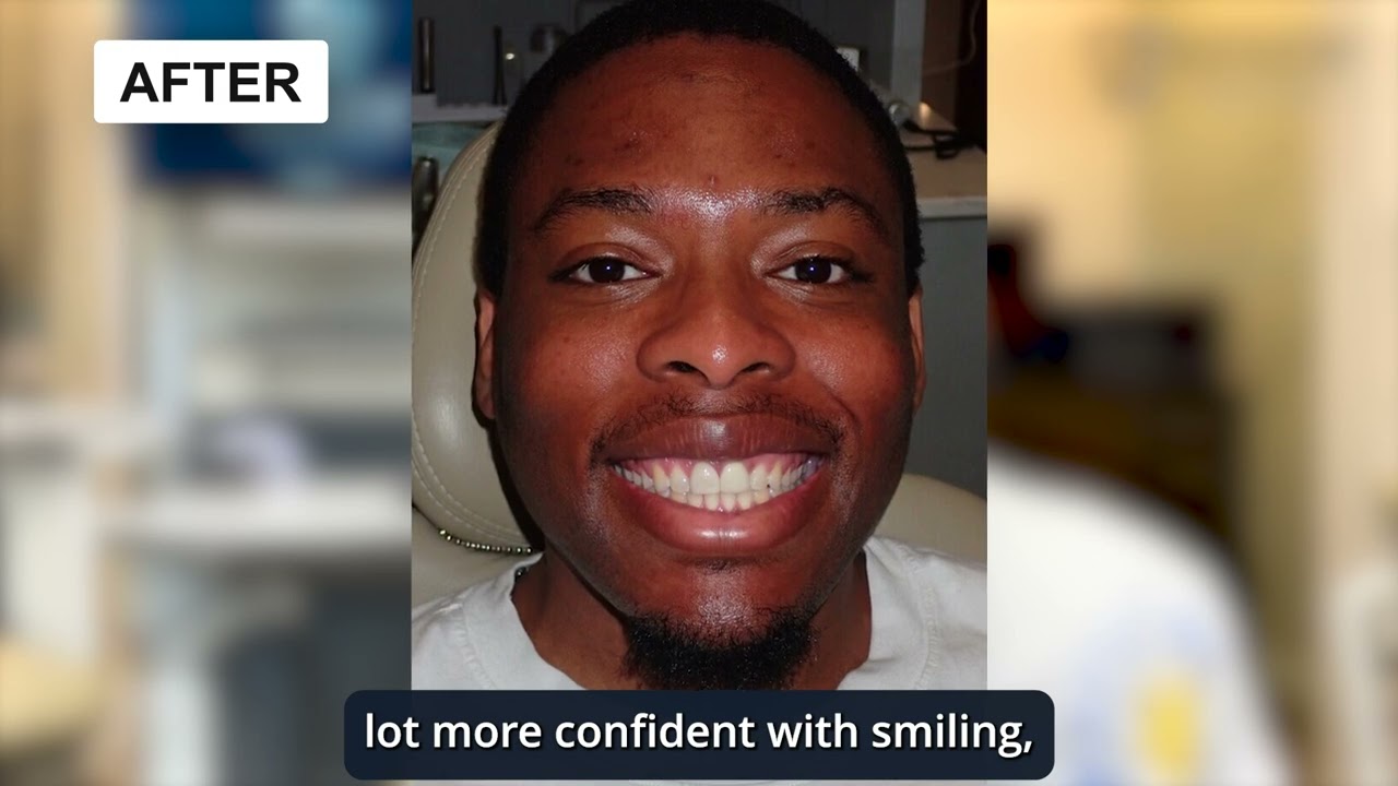 Renew Dental - Shay&#039;s Experience