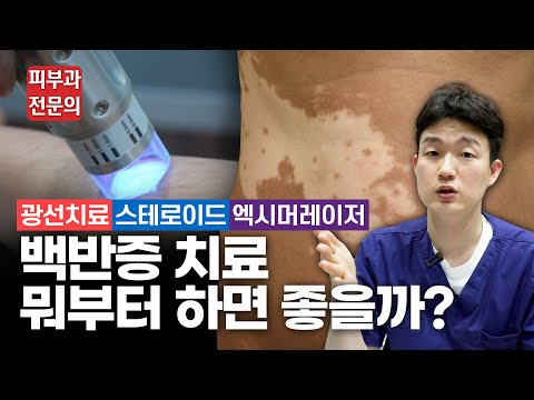 백반증 비수술적 치료의 방법과 부작용 - 광선치료, 엑시머레이저, 스테로이드, 칼시뉴린억제제