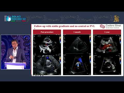 ✅ Structural: Selected Topics in TAVI - SOLACI-SOCIME 2022
