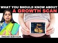 Growth Scan In Pregnancy கரு வளர்ச்சி ஸ்கேன் பற்றி ந�