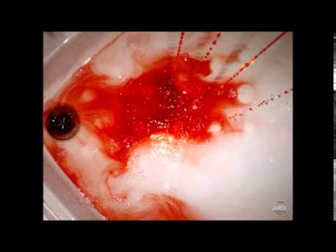 Tragican zivot Nikole Lukica