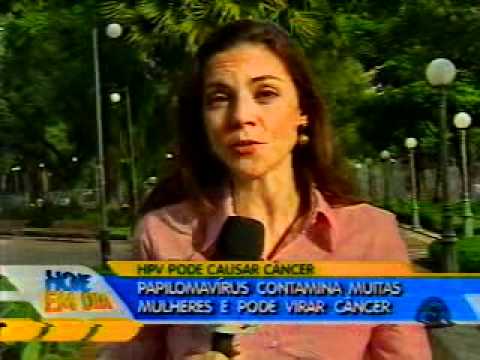 Papilomavírus contamina muitas mulheres - 01/06/2011
