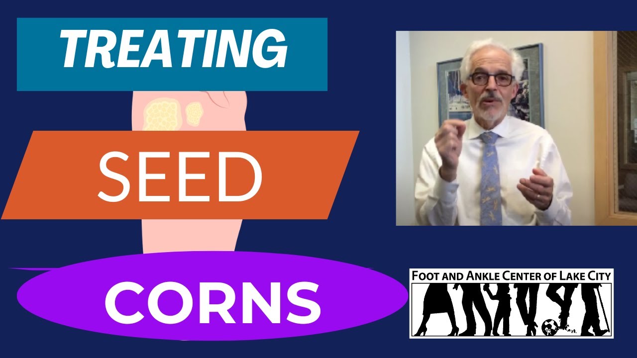 Do You Feel Like You're Walking on a Pebble?