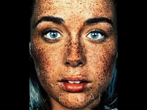 無数の女性には奇妙なそばかすが共通している - それは珍しい場所にある