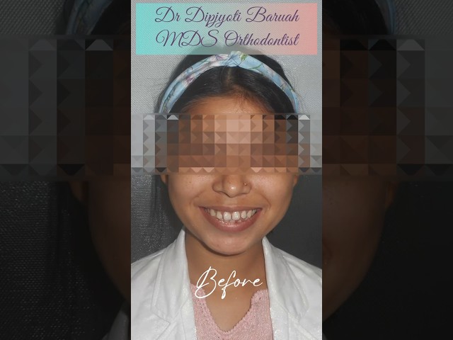 Thumbnail for Post ID: yIUzB5kT8w8