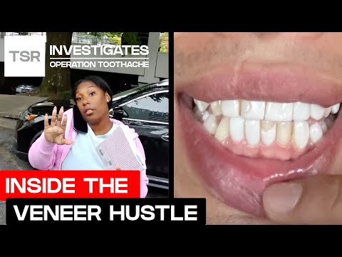 Undercover at a Fake Veneer School—You Won’t Believe What We Found | TSR Investigates