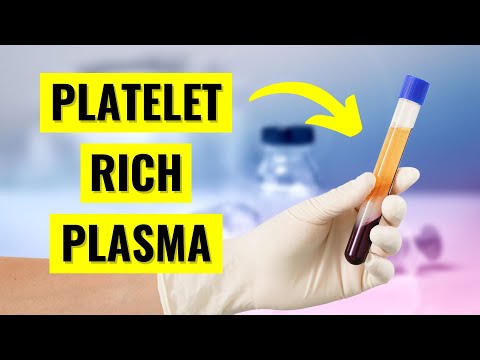 Können PRP-Injektionen tatsächlich Rotatorenmanschettenrisse heilen?