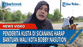 PENDERITA KUSTA SICANANG Harap Wali Kota Bobby Nasution Melihat Kondisi Mereka dan Berikan Bantuan Mp4 3GP & Mp3