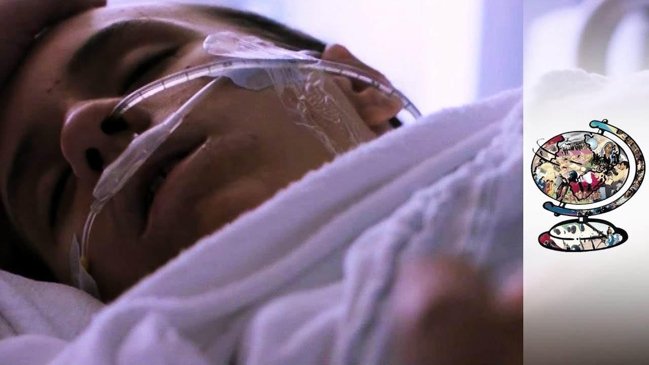 Treating The Most Severe Cases Of Tourette's Syndrome