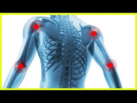 Ursachen der Bursitis des Kniegelenks Thoraxskoliosebehandlung bei Kindern