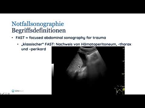 Einführung Basiskurs Notfallsonographie (FAST, eFAST, FASTplus, FEEL)