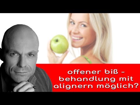 offener biss - ist eine behandlung mit aligner möglich?