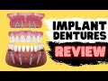 Implant Dentures vs Snap In Dentures vs All on 4