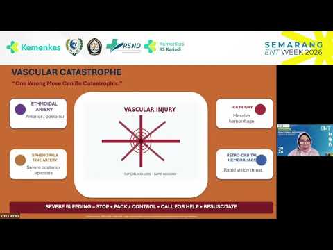 Avoiding Complication in FESS