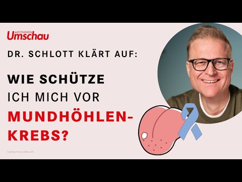 Mundhöhlenkrebs - häufige Fragen